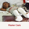 a little boy laying down with both legs in plaster casts